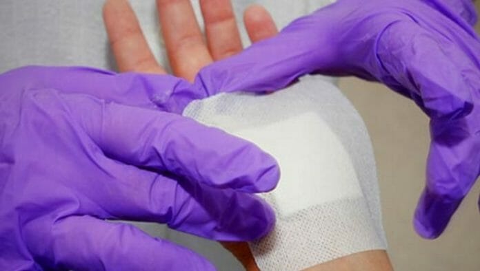 FLEXcon, dermaFLEX, Silikonkleber